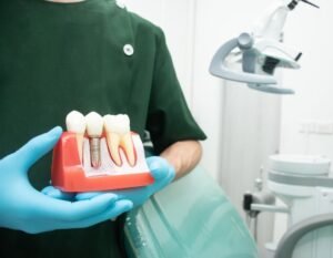 Modelo de implantes dentales en mano