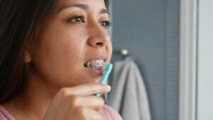 cuidados de brackets metálicos