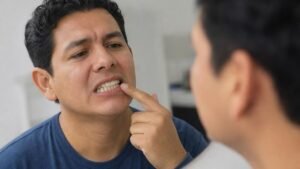 tipos de problemas de mordida